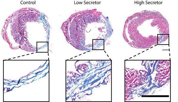 In a lab model, heart tissue treated with high-secreting stem cells (right) showed more regeneration than heart tissue treated with low-secreting cells (middle) or receiving no treatment (left).
